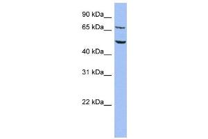 WB Suggested Anti-REPIN1  Antibody Titration: 0. (REPIN1 antibody  (Middle Region))