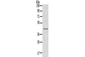 Gel: 8 % SDS-PAGE, Lysate: 60 μg, Lane: Raji cells, Primary antibody: ABIN7130829(RASSF7 Antibody) at dilution 1/800, Secondary antibody: Goat anti rabbit IgG at 1/8000 dilution, Exposure time: 5 seconds (RASSF7 antibody)
