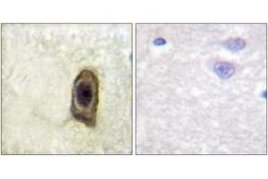 Immunohistochemistry analysis of paraffin-embedded human brain, using CSFR (Phospho-Tyr561) Antibody. (CSF1R antibody  (pTyr561))