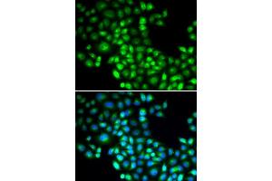 Immunofluorescence analysis of U2OS cells using FOXP1 antibody (ABIN5973033). (FOXP1 antibody)