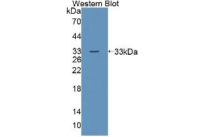 Detection of Recombinant TESK1, Human using Polyclonal Antibody to Testis Specific Kinase 1 (TESK1) (TSSK1 antibody  (AA 57-314))