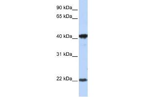 WB Suggested Anti-LIN7C Antibody Titration:  1 ug/ml  Positive Control:  MCF-7 whole cell lysates LIN7C is supported by BioGPS gene expression data to be expressed in MCF7 (LIN7C antibody  (Middle Region))