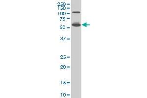 IRF5 monoclonal antibody (M05), clone 2D4 Western Blot analysis of IRF5 expression in A-431 . (IRF5 antibody  (AA 395-504))
