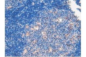 IHC-P analysis of Mouse Lymph Node Tissue, with DAB staining.