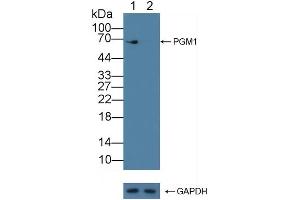 anti-Phosphoglucomutase 1 (PGM1) (AA 1-235) antibody