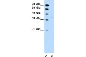 WB Suggested Anti-HSD17B1 Antibody Titration:  0. (HSD17B1 antibody  (N-Term))