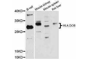 Western blot analysis of extracts of various cell lines, using HLA-DOB antibody (ABIN5997898) at 1:3000 dilution. (HLA-DOB antibody)