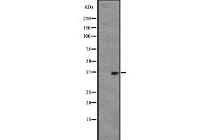 Human normal uterus tissue lysate ;developed using the ECL technique (OR2W1 antibody  (C-Term))