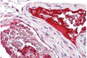 Human Colon, Vessels: Formalin-Fixed, Paraffin-Embedded (FFPE) (CLEC7A antibody  (AA 36-127))