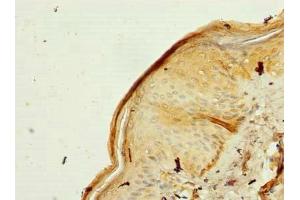 Immunohistochemistry of paraffin-embedded human skin tissue using ABIN7142443 at dilution of 1:100 (MRPL53 antibody  (AA 8-113))