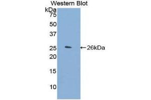 Western Blotting (WB) image for anti-Filamin C, gamma (FLNC) (AA 2519-2725) antibody (ABIN1858904) (FLNC antibody  (AA 2519-2725))