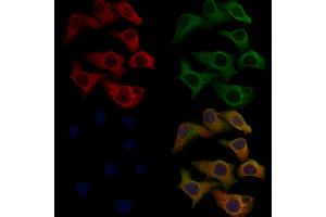 anti-Somatostatin Receptor 1 (SSTR1) (C-Term) antibody
