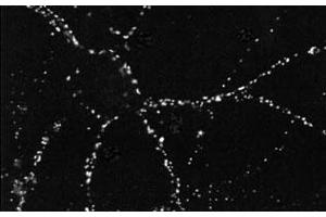 Immunofluorescence staining in dissociated hippocampal neurons with Psd monoclonal antibody, clone 6G6 . (PSD antibody)