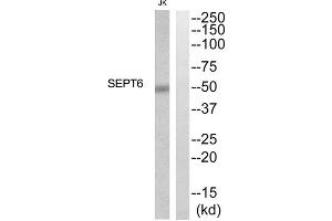 Western blot analysis of extracts from Jurkat cells, using SEPT6 antibody. (Septin 6 antibody  (Internal Region))