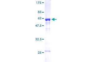 MED4 Protein (AA 1-270) (GST tag)