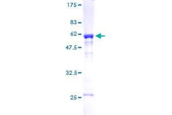 MED4 Protein (AA 1-270) (GST tag)
