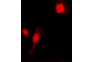 Immunofluorescent analysis of MMP2 staining in COLO205 cells. (MMP2 antibody  (C-Term))
