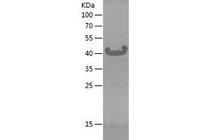 Western Blotting (WB) image for GNAS Complex Locus (GNAS) (AA 47-245) protein (His tag) (ABIN7282902) (GNAS Protein (AA 47-245) (His tag))
