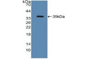 Detection of Recombinant ATF4, Human using Polyclonal Antibody to Activating Transcription Factor 4 (ATF4) (ATF4 antibody  (AA 130-347))