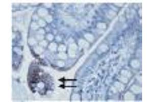 Image no. 1 for anti-Toll-Like Receptor 3 (TLR3) antibody (ABIN187555) (TLR3 antibody)