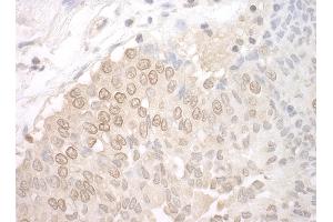 anti-Uridine-Cytidine Kinase 1-Like 1 (UCKL1) (AA 50-100) antibody