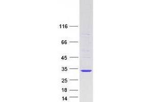 Validation with Western Blot (RRAS2 Protein (Transcript Variant 1) (Myc-DYKDDDDK Tag))