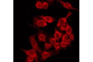 ABIN6274024 staining HepG2 by IF/ICC. (MHC, Class I antibody)