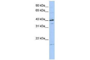 Western Blotting (WB) image for anti-Tubulin Polymerization-Promoting Protein Family Member 3 (TPPP3) antibody (ABIN2458655) (TPPP3 antibody)