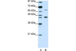 Western Blotting (WB) image for anti-Retinoic Acid Receptor, alpha (RARA) antibody (ABIN2462093) (Retinoic Acid Receptor alpha antibody)
