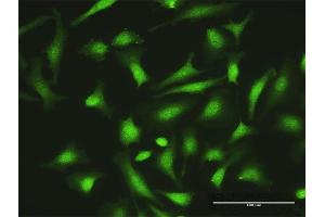 Immunofluorescence of purified MaxPab antibody to ZNF511 on HeLa cell.