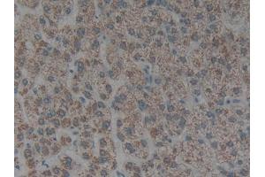 Immunohistochemistry (IHC) image for anti-Keratin 1 (KRT1) (AA 487-644) antibody (ABIN7431881)