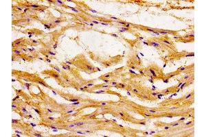 Immunohistochemistry of paraffin-embedded human heart tissue using ABIN7145958 at dilution of 1:100 (CCL15 antibody  (AA 22-113))