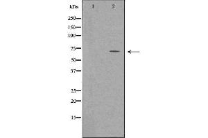 Western blot analysis of extracts from Rat Heart cells using SLC22A5 antibody.