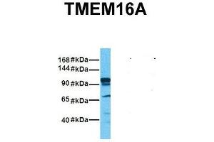Host:  Rabbit  Target Name:  TMEM16A  Sample Tissue:  Human Fetal Liver  Antibody Dilution:  1. (ANO1 antibody  (Middle Region))