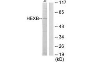 Western blot analysis of extracts from Jurkat cells, using HEXB Antibody.
