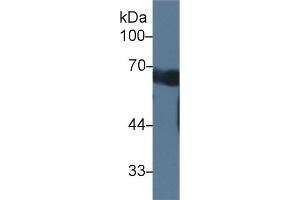 Detection of CCDC60 in Mouse Serum using Polyclonal Antibody to Coiled Coil Domain Containing Protein 60 (CCDC60) (CCDC60 antibody  (AA 1-186))