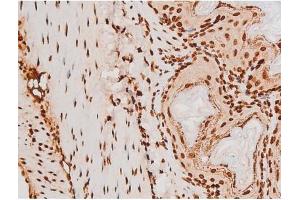 Immunohistochemistry (IHC) image for anti-REL proto-oncogene (c-Rel) (pSer503) antibody (ABIN6255382)