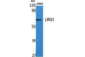 Western Blot (WB) analysis of specific cells using LRG1 Polyclonal Antibody. (LRG1 antibody  (C-Term))