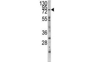 Western Blotting (WB) image for anti-Myosin Light Chain Kinase 3 (MYLK3) (AA 40-69) antibody (ABIN3031919)