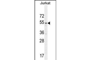 P1 Antibody (Center) (ABIN654665 and ABIN2844361) western blot analysis in Jurkat cell line lysates (35 μg/lane). (MPP1 antibody  (AA 301-327))