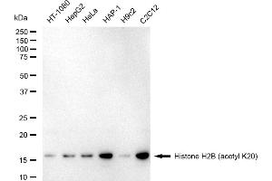 Western blotting analysis using Histone H2B (acetyl K20) antibody (ABIN7798944).