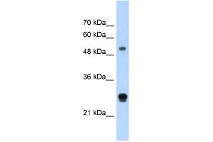 IGSF1 antibody used at 1. (IGSF1 antibody  (N-Term))