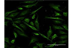 Immunofluorescence of monoclonal antibody to SFTPA1 on HeLa cell. (Surfactant Protein A1 antibody  (AA 83-199))