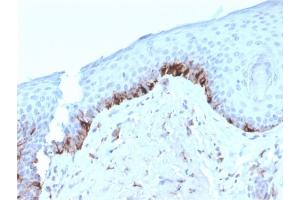 Formalin-fixed, paraffin-embedded human Skin stained with TYRP1-Monospecific Mouse Monoclonal Antibody (TYRP1/3282). (Tyrosinase-Related Protein 1 antibody  (AA 257-377))