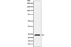 Western blot analysis of Casein expression in Human milk lysate.