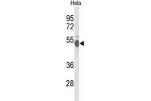 Western blot analysis of CREB3L2 Antibody (C-term) in Hela cell line lysates (35µg/lane).