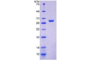 SDS-PAGE analysis of Human ELMO2 Protein. (ELMO2 Protein)