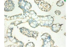 Immunohistochemistry of paraffin-embedded human small intestine tissue using ABIN7159541 at dilution of 1:100 (MT2A antibody  (AA 1-59))