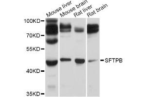 Western blot analysis of extracts of various cell lines, using SFTPB Antibody (ABIN5995955) at 1/1000 dilution. (SFTPB antibody)