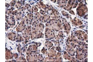 Image no. 5 for anti-Destrin (Actin Depolymerizing Factor) (DSTN) antibody (ABIN1497910) (Destrin antibody)